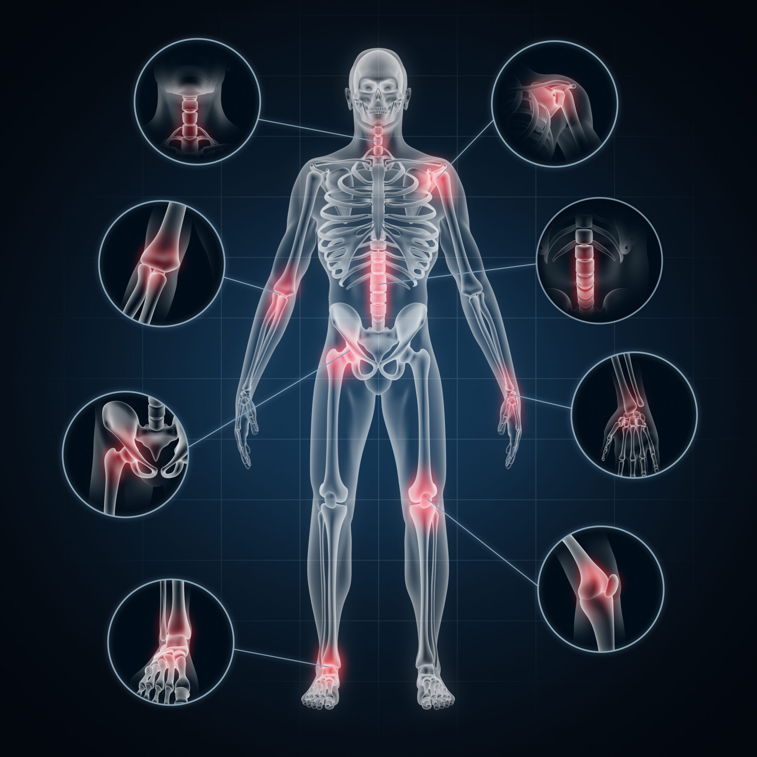 X-ray,Full,Body,Of,Human,Skeleton,,Osteoarthritis.,3d,Rendering